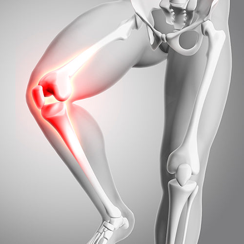 Sistema Osteoarticular